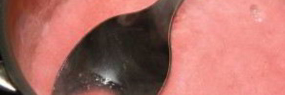 мусс из фруктов