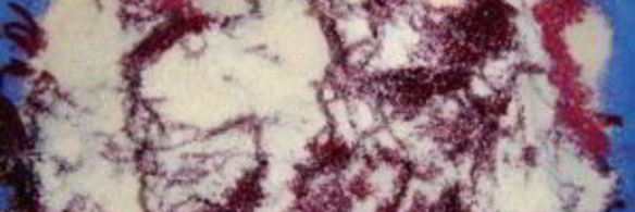 котлеты из свеклы