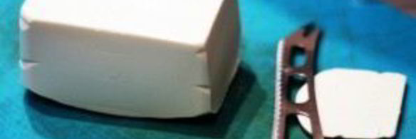 пирог из слоеного теста с сыром и баклажаном