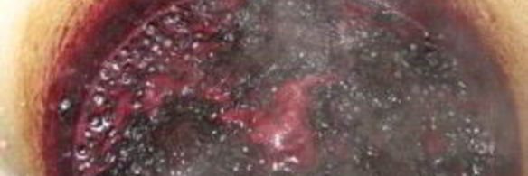 конфитюр из черники