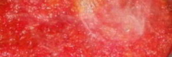 варенье из грейпфрута